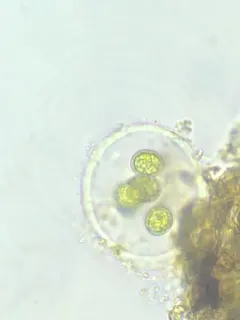 Asterococcus limneticus thumbnail 2