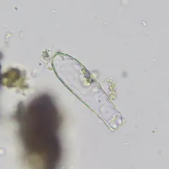 Euglypha cristata thumbnail 1