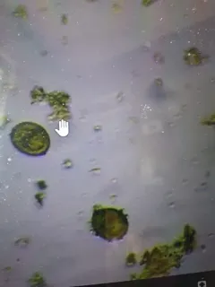 Trachelomonas armata thumbnail 4
