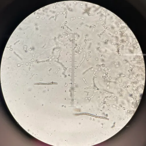 Atichia glomerulosa