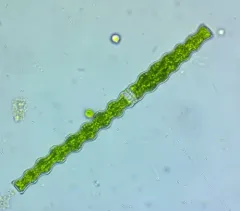 Docidium undulatum thumbnail 1