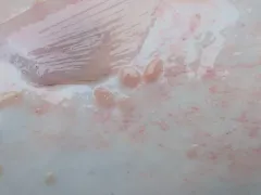 Entobdella hippoglossi thumbnail 1