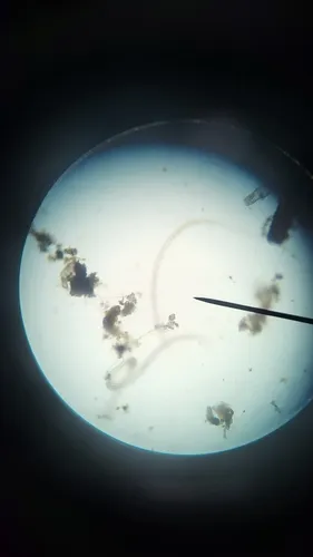 Human pinworm
