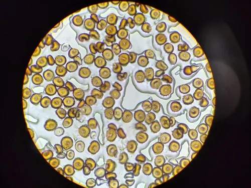 Puccinia nuda