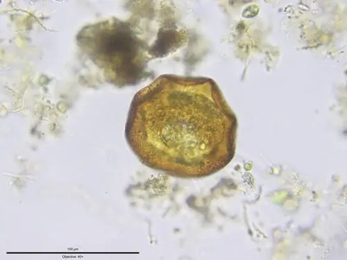 Arcella conica