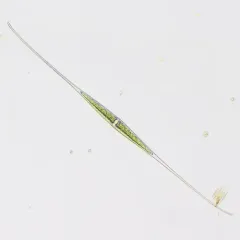 Closterium kuetzingii thumbnail 1