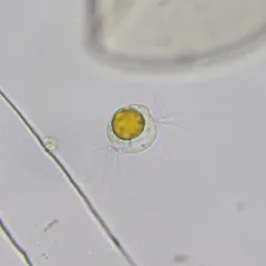 Diplophrys archeri thumbnail 2