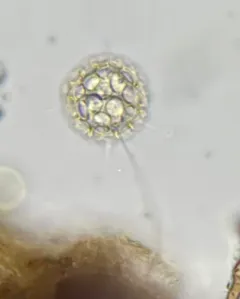 Clathrulina elegans thumbnail 3