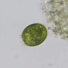 Trachelomonas armata thumbnail 1