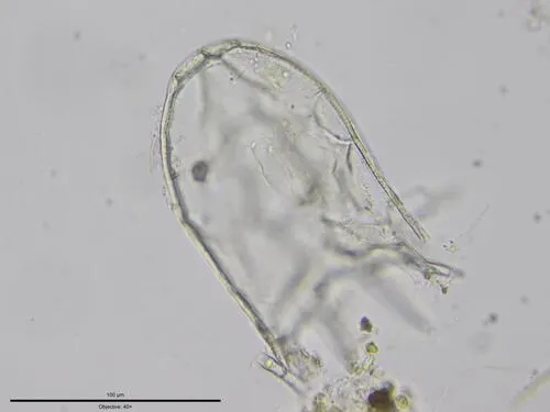Keratella ticinensis