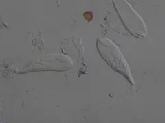 Mniaecia nivea thumbnail 1