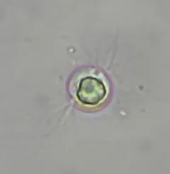 Diplophrys archeri thumbnail 4
