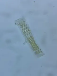 Fragilaria capucina thumbnail 4