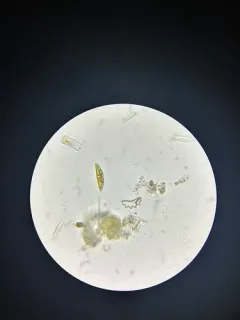 Eunotia diadema thumbnail 2