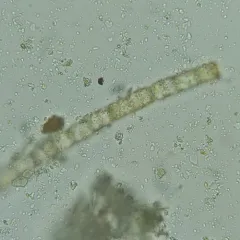 Melosira varians thumbnail 4