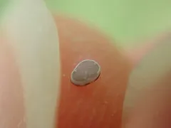 Aleurochiton forbesii thumbnail 4