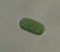 Cyanothece aeruginosa thumbnail 2