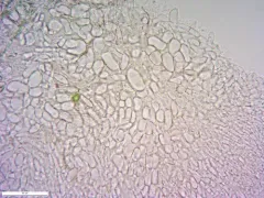 Helotium schimperi thumbnail 2