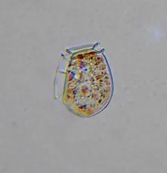 Dinophysis acuminata thumbnail 2