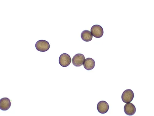 Physarum ovisporum