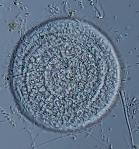 Trichodina pediculus
