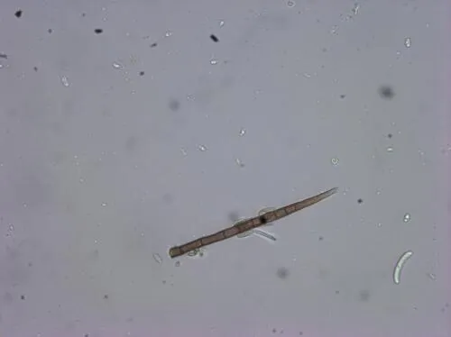 Zanclospora novae-zelandiae