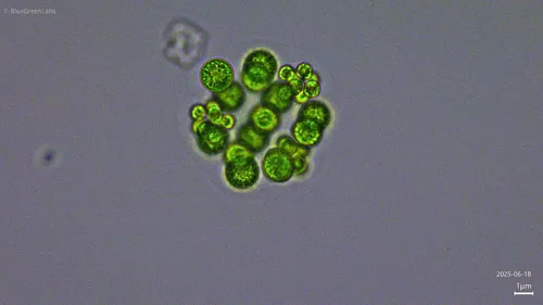 Sphaerocystis schroeteri