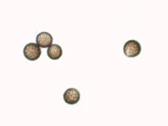 Diderma asteroides thumbnail 2
