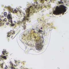 Brachionus quadridentatus thumbnail 1