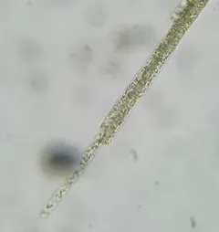 Aphanizomenon flosaquae thumbnail 4
