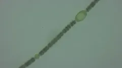 Dolichospermum planctonicum thumbnail 3