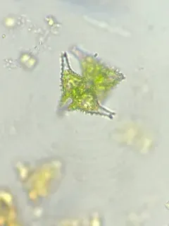 Staurastrum hystrix thumbnail 3