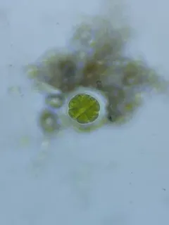 Pandorina morum thumbnail 4