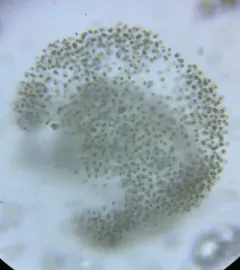 Microcystis flos-aquae thumbnail 1
