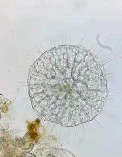 Actinophrys sol thumbnail 3