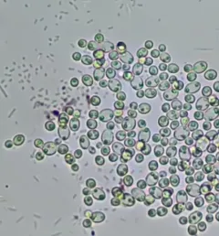 baker's yeast thumbnail 1