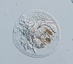 Testudinella patina thumbnail 1