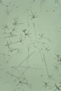 Heterochone calyx thumbnail 3