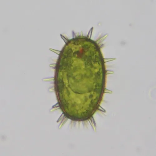 Trachelomonas megalacantha