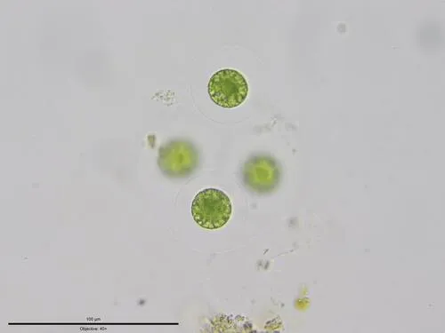 Asterococcus superbus