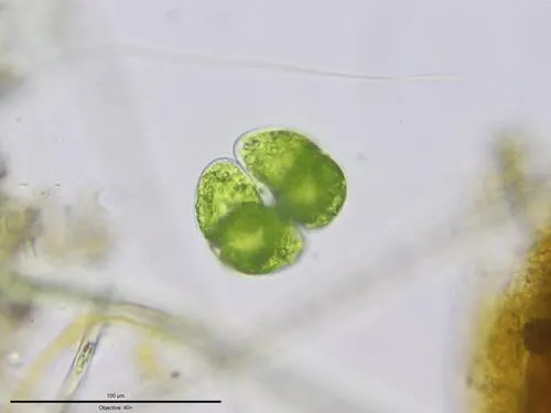 Staurastrum orbiculare