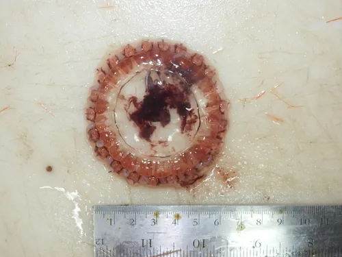 Atolla Jelly
