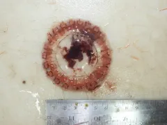Atolla Jelly thumbnail 1