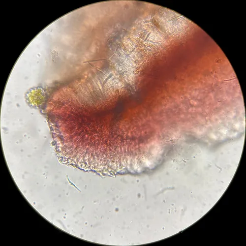 Bacidia polychroa