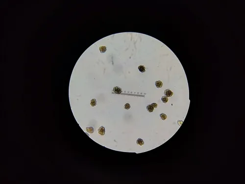 Urocystis carcinodes