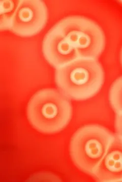 staph aureus thumbnail 2