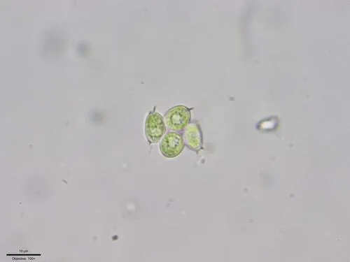 Desmodesmus denticulatus