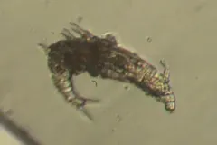 Dissotrocha aculeata thumbnail 2