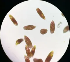 Euglena sanguinea thumbnail 4