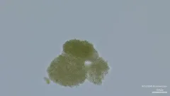 Microcystis flos-aquae thumbnail 2